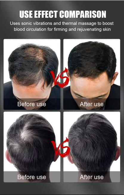 EcoWave® Tech – Red Light Therapy Cap for Hair Regrowth